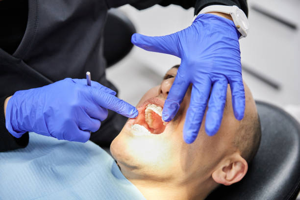 Best Knocked-Out Tooth Emergency  in Mona, UT